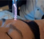 Hot & Cold Plasma Fusion, pažangus plazminės grožio sistemos aparatas - Image 3